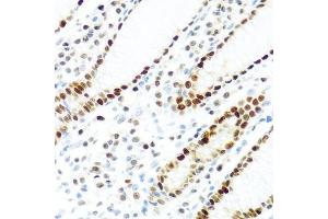 Immunohistochemistry (Paraffin-embedded Sections) (IHC (p)) image for anti-KH Domain Containing, RNA Binding, Signal Transduction Associated 2 (KHDRBS2) (C-Term) antibody (ABIN6142831)