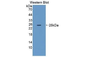 Detection of Recombinant F13B, Mouse using Polyclonal Antibody to Coagulation Factor XIII B Polypeptide (F13B)