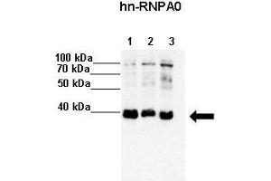 Lanes :  Lane 1: 20ug HeLa S3 lysate Lane 2: 20ug MCF7 lysate Lane 3: 20ug K562 lysate   Primary Antibody Dilution :   1:4000    Secondary Antibody :  Anti-rabbit-HRP   Secondary Antibody Dilution :   1:5000   Gene Name :  HNRPA0   Submitted by :  Anonymous (HNRNPA0 antibody  (Middle Region))