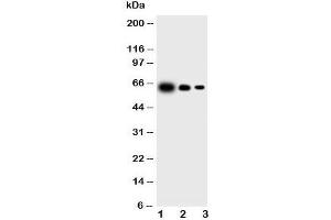 Western blot testing of IL23 p19 antibody and Lane 1:  recombinant mouse protein 10ng;  2: 5ng;  3: 2.