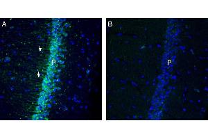 Immunohistochemistry (IHC) image for anti-Potassium Intermediate/small Conductance Calcium-Activated Channel, Subfamily N, Member 1 (KCNN1) (AA 75-93), (Intracellular) antibody (ABIN7043459)