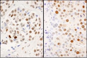 Immunohistochemistry (IHC) image for anti-Minichromosome Maintenance Complex Component 2 (MCM2) (pSer53) antibody (ABIN7449369)