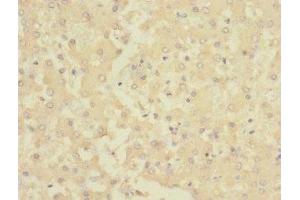 Immunohistochemistry of paraffin-embedded human liver tissue using ABIN7142967 at dilution of 1:100 (CHRNE antibody  (AA 21-239))