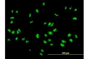 Immunofluorescence of purified MaxPab antibody to RSL1D1 on HeLa cell. (RSL1D1 antibody  (AA 1-490))