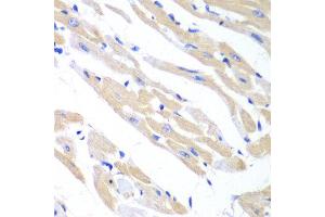Immunohistochemistry of paraffin-embedded mouse heart using TRIM21 antibody at dilution of 1:100 (x40 lens). (TRIM21 antibody)