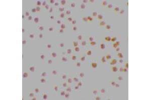 Immunocytochemical staining of MOLT4 cells using DRAK1 antibody at 2μg/ml. (STK17A antibody  (AA 5-19))