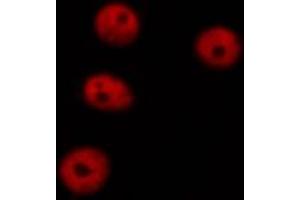 F7376 staining HEPG2 cells by ICC/IF. (DNMT1 antibody  (Internal Region))
