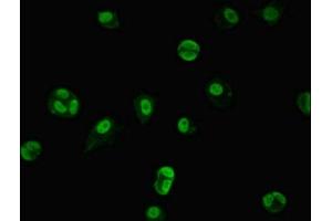 Immunofluorescent analysis of MCF-7 cells using ABIN7151258 at dilution of 1:100 and Alexa Fluor 488-congugated AffiniPure Goat Anti-Rabbit IgG(H+L) (TRIM33 antibody  (AA 1-273))