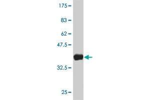 Western Blot detection against Immunogen (37. (LGI2 antibody  (AA 446-545))