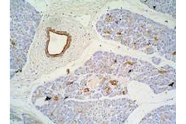 Keratin 7/17 antibody
