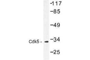 Image no. 1 for anti-Cyclin-Dependent Kinase 5 (CDK5) antibody (ABIN317893) (CDK5 antibody)