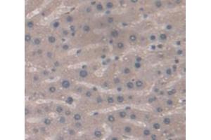 Used in DAB staining on fromalin fixed paraffin- embedded Kidney tissue (NOS2 antibody  (AA 530-693))