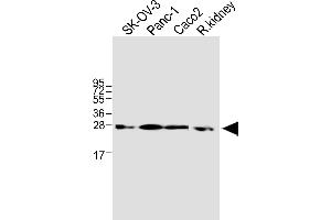 All lanes : Anti-TMEM97 Antibody (N-term) at 1:1000 dilution Lane 1: SK-OV-3 whole cell lysate Lane 2: Panc-1 whole cell lysate Lane 3: Caco2 whole cell lysate Lane 4: rat kidney lysate Lysates/proteins at 20 μg per lane. (TMEM97 antibody  (N-Term))