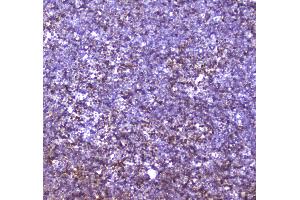 Immunohistochemistry (IHC) image for anti-Core-Binding Factor, beta Subunit (CBFB) (AA 1-182) antibody (ABIN5693076)
