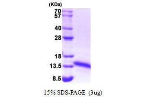 SDS-PAGE (SDS) image for Ferredoxin1 (FDX1) (AA 61-184) protein (HIS-T7) (ABIN666783)