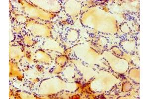 Immunohistochemistry of paraffin-embedded human thyroid tissue using ABIN7148757 at dilution of 1:100 (Cullin 4B antibody  (AA 1-200))
