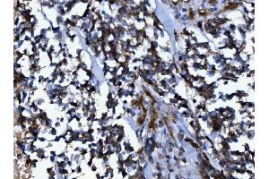 anti-Numb Homolog (NUMB) (AA 194-220), (N-Term) antibody