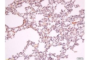 Formalin-fixed and paraffin embedded rat lung labeled with Anti-Endothelial lipase Polyclonal Antibody, Unconjugated  at 1:200 followed by conjugation to the secondary antibody and DAB staining. (LIPG antibody  (AA 301-400))