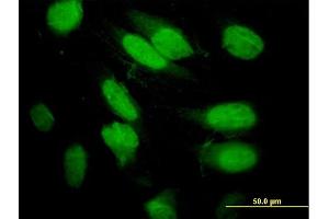 Immunofluorescence of purified MaxPab antibody to SEPT2 on HeLa cell. (Septin 2 antibody  (AA 1-361))