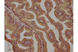 IHC image of ABIN7139908 diluted at 1:800 and staining in paraffin-embedded human prostate tissue performed on a Leica BondTM system. (EDG4 antibody  (AA 8-27))
