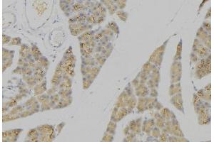 ABIN6276634 at 1/100 staining Human pancreas tissue by IHC-P. (PLA2G2A antibody  (Internal Region))