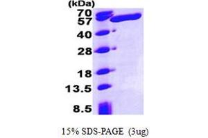 SDS-PAGE (SDS) image for Aldehyde Dehydrogenase 3 Family, Member A1 (ALDH3A1) (AA 1-453) protein (His tag) (ABIN667760) (ALDH3A1 Protein (AA 1-453) (His tag))