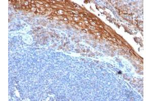 Image no. 1 for anti-Melanoma Cell Adhesion Molecule (MCAM) antibody (ABIN6153528)