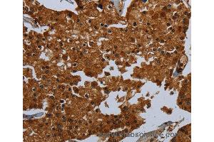 Immunohistochemistry of Human brain  using ENTPD7 Polyclonal Antibody at dilution of 1:60