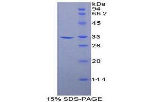 SDS-PAGE (SDS) image for Annexin A6 (ANXA6) (AA 251-504) protein (His tag) (ABIN2124025)
