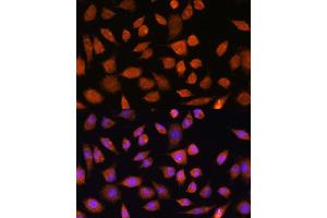 Immunofluorescence analysis of L929 cells using PLD3 Rabbit pAb (ABIN7269351) at dilution of 1:100. (PLD3 antibody)