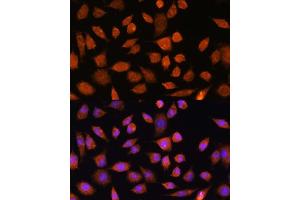 Immunofluorescence analysis of L929 cells using PLD3 Rabbit pAb (ABIN7269351) at dilution of 1:100. (PLD3 antibody)