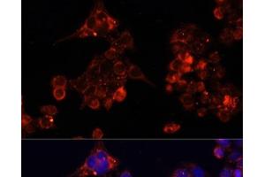 Immunofluorescence analysis of HeLa cells using B4GALT4 Polyclonal Antibody at dilution of 1:100. (B4GALT4 antibody)