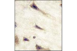 Immunohistochemistry (IHC) image for anti-EPH Receptor A5 (EPHA5) antibody (ABIN356398) (EPH Receptor A5 antibody)