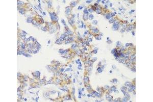 Immunohistochemistry (Paraffin-embedded Sections) (IHC (p)) image for anti-Mitochondrial Import Receptor Subunit TOM20 homolog (TOMM20) antibody (ABIN7259444)