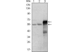 Western Blot showing ETS1 antibody used against Jurkat (1), HepG2 (2) and ETS1-hIgGFc transfected HEK293 (3) cell lysate.