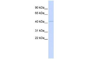 WB Suggested Anti-MITF Antibody Titration:  0. (MITF antibody  (Middle Region))