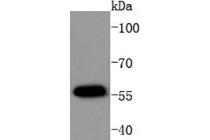 MCF-7 Cell lysates, probed with AKT1(T450) (4A3) Monoclonal Antibody  at 1:1000 overnight at 4˚C. (AKT1 antibody  (pThr450))