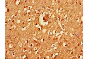 Immunohistochemistry of paraffin-embedded human brain tissue using ABIN7155237 at dilution of 1:100 (HRH3 antibody  (AA 236-332))