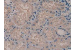 IHC-P analysis of Human Kidney Tissue, with DAB staining. (ADCY7 antibody  (AA 806-1052))