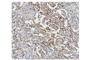 IHC analysis of STAT1 using anti STAT1 antibody (ABIN6719375).