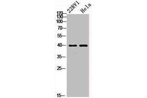 Western Blot analysis of 22RV1 HELA cells using PKAα/β/γ cat Polyclonal Antibody (PRKACA + PRKACB + PRKACG antibody)