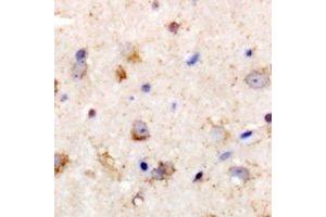 Immunohistochemical analysis of PGD2 synthase staining in rat brain formalin fixed paraffin embedded tissue section. (PTGDS antibody)