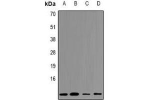 Western blot analysis of Cystatin A expression in HEK293T (A), Hela (B), NIH3T3 (C), mouse kidney (D) whole cell lysates. (CSTA antibody  (C-Term))