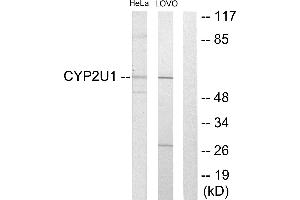 Western blot analysis of extracts from HeLa cells and Lovo cells, using Cytochrome P450 2U1 antibody. (CYP2U1 antibody)
