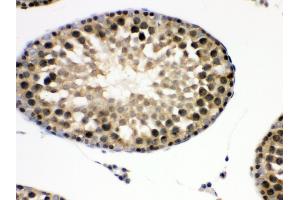 Immunohistochemistry (IHC) image for anti-Eukaryotic Translation Initiation Factor 6 (EIF6) (AA 66-210) antibody (ABIN3043427)
