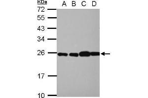 WB Image Sample (30 ug of whole cell lysate) A: NT2D1 B: PC-3 C: U87-MG D: SK-N-SH 12% SDS PAGE antibody diluted at 1:10000 (RPL29 antibody)