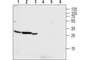 Western blot analysis of human pancreatic carcinoma PANC-1 (lanes 1 and 4), mouse kidney (lanes 2 and 5) and rat kidney (lanes 3 and 6) lysates: - 1-3. (CLIC4 antibody  (Intracellular, N-Term))