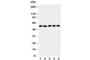 Western blot testing of HYAL2 antibody and Lane 1:  HeLa (HYAL2 antibody  (AA 142-157))