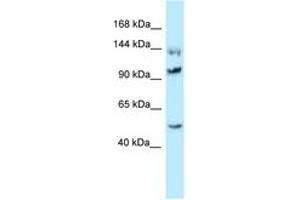 Image no. 1 for anti-Heat Shock 105kDa/110kDa Protein 1 (HSPH1) (C-Term) antibody (ABIN6747876) (HSPH1 antibody  (C-Term))