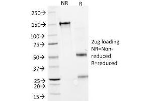 SDS-PAGE Analysis Purified IFNA2 Mouse Monoclonal Antibody (N27).